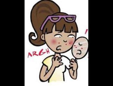 "青春痘" 的英文怎麼說?